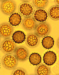 Teliospores of Tilletia controversa, the dwarf bunt fungus