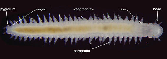 Ophryotrocha habitus